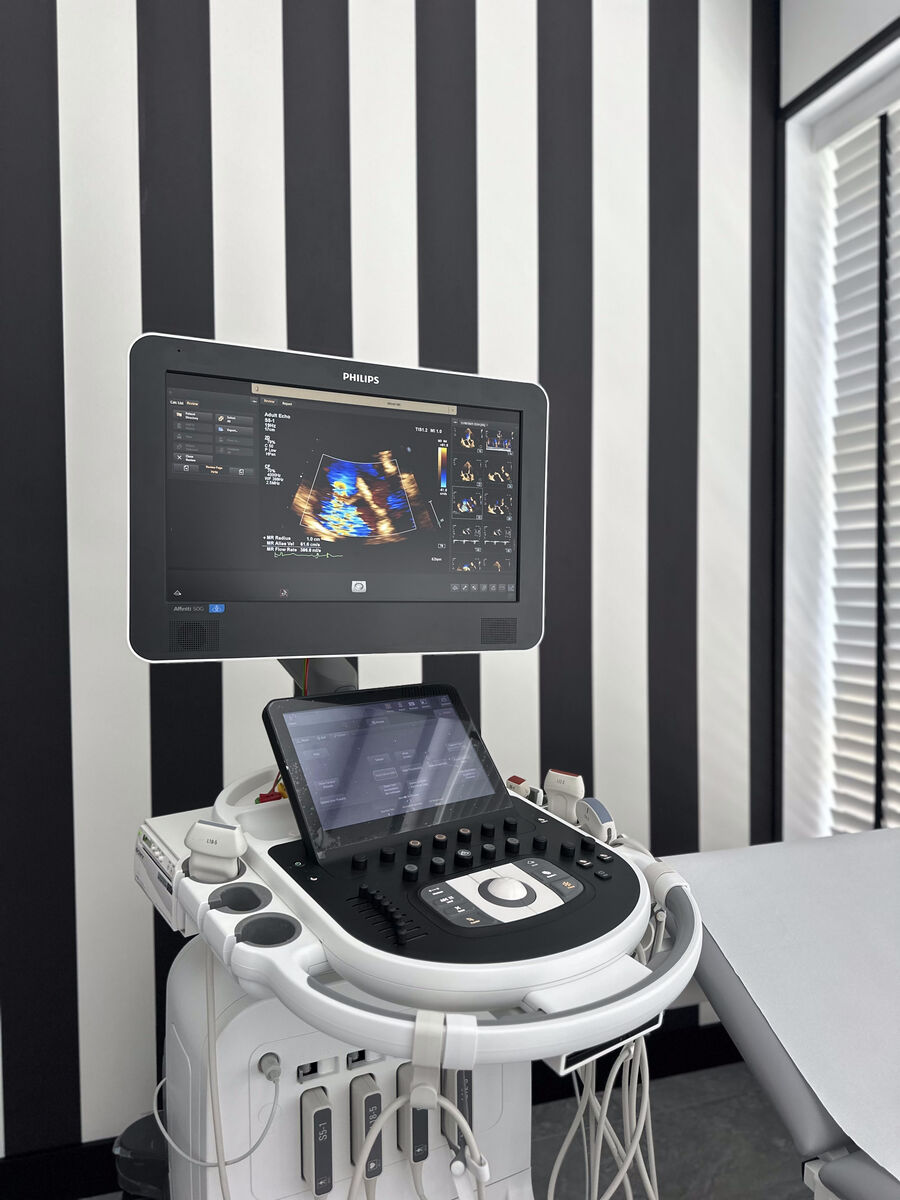 Aparat echokardiograficzny Philips Affiniti 50G obok kozetki w gabinecie echo serca Przychodni Medecho w Warszawie