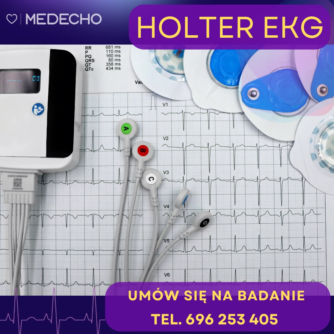 Holter EKG w Przychodni Medecho: rejestrator, elektrody i zapis EKG